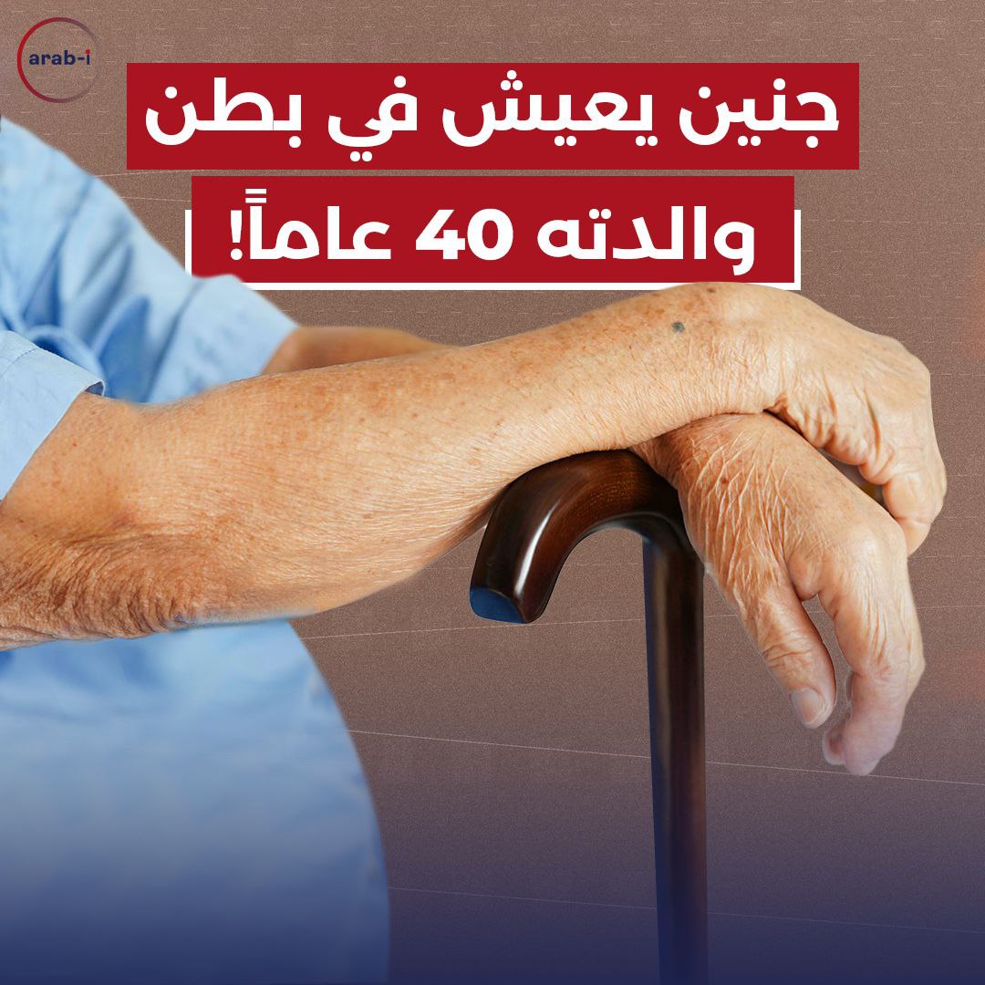 جنين يعيش في بطن والدته 40 عاماً!