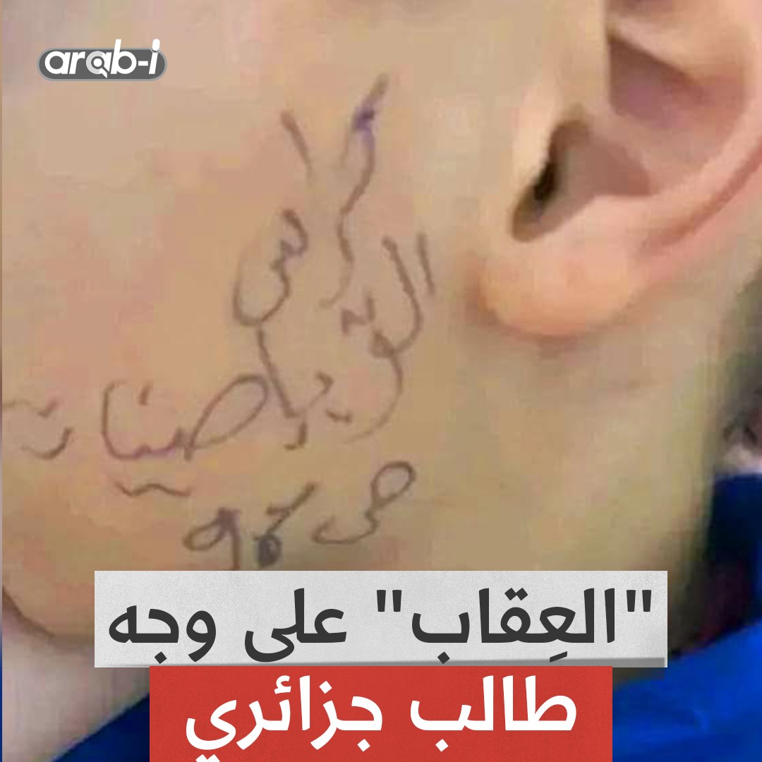 نسي إحضار دفتره… فـ كُتب القصاص على وجهه ما قصة صورة الطفل الجزائري؟